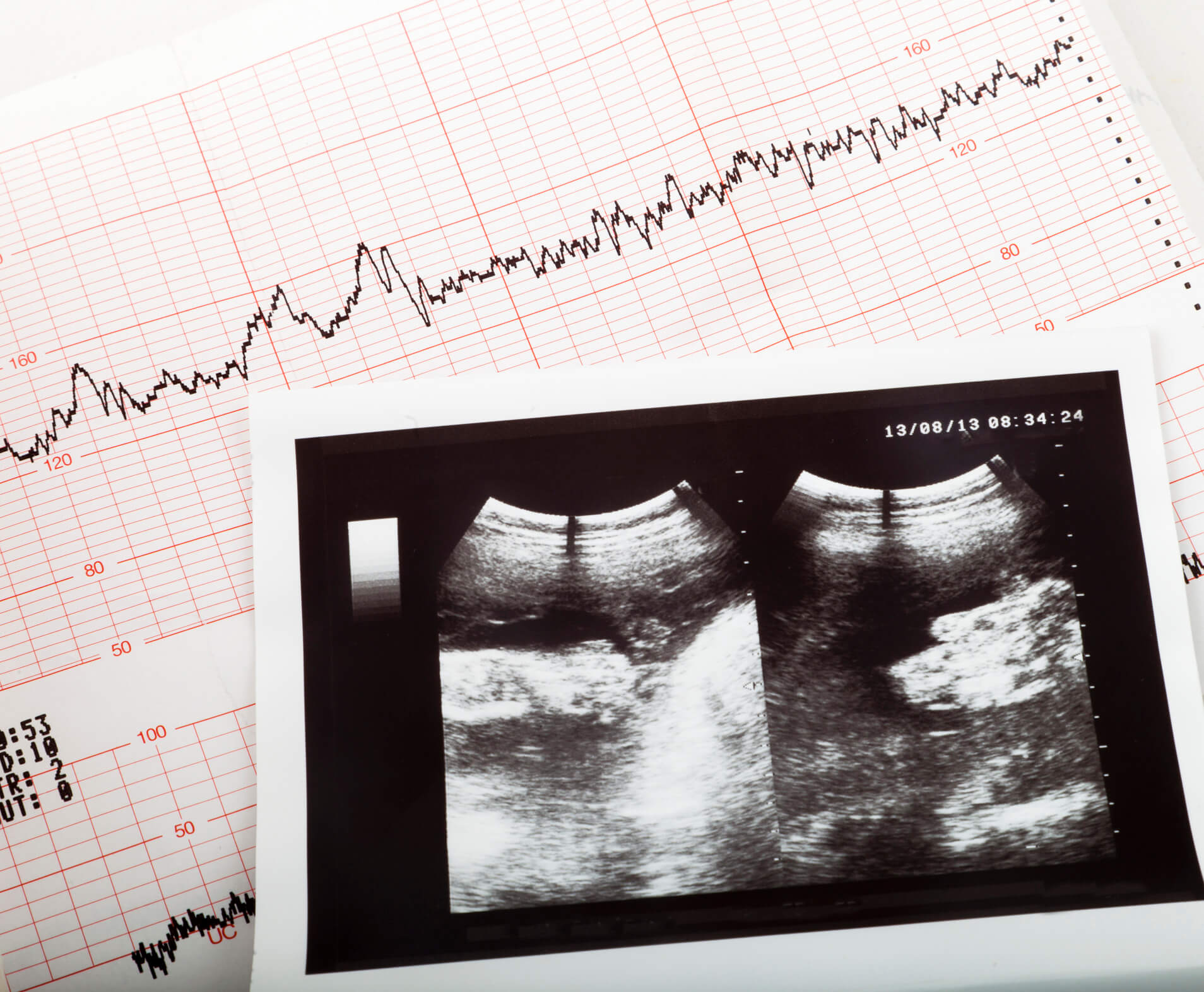 Doppler Ultrasound: What Is It and What To Expect?